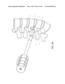 ARTIFICIAL DISC diagram and image