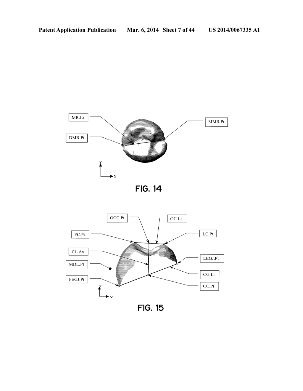 CUSTOM ORTHODONTIC APPLIANCE SYSTEM AND METHOD - diagram, schematic, and image 08