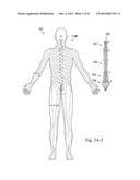 Method and System of Suggesting Spinal Cord Stimulation Region Based on     Pain and Stimulation Maps with a Clinician Programmer diagram and image