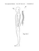 Method and System of Suggesting Spinal Cord Stimulation Region Based on     Pain and Stimulation Maps with a Clinician Programmer diagram and image