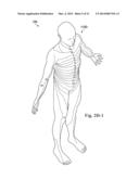 Method and System of Suggesting Spinal Cord Stimulation Region Based on     Pain and Stimulation Maps with a Clinician Programmer diagram and image