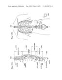 Method and System of Suggesting Spinal Cord Stimulation Region Based on     Pain and Stimulation Maps with a Clinician Programmer diagram and image