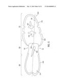 Article of Footwear With Elongated Shock Absorbing Heel System diagram and image