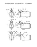 CAN OPENING DEVICE diagram and image