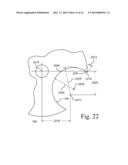 Dual tip seals for a rotary engine diagram and image