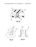 PAP SYSTEM BLOWER diagram and image