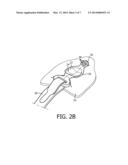 LOW PROFILE MASK ATTACHMENT ELEMENT diagram and image