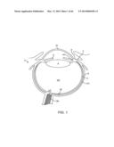 CONFORMABLE THERAPEUTIC SHIELD FOR VISION AND PAIN diagram and image