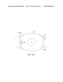 CONFORMABLE THERAPEUTIC SHIELD FOR VISION AND PAIN diagram and image