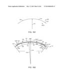 CONFORMABLE THERAPEUTIC SHIELD FOR VISION AND PAIN diagram and image