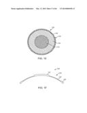 CONFORMABLE THERAPEUTIC SHIELD FOR VISION AND PAIN diagram and image