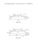 CONFORMABLE THERAPEUTIC SHIELD FOR VISION AND PAIN diagram and image