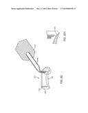 CONFORMABLE THERAPEUTIC SHIELD FOR VISION AND PAIN diagram and image