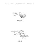 CONFORMABLE THERAPEUTIC SHIELD FOR VISION AND PAIN diagram and image