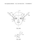 CONFORMABLE THERAPEUTIC SHIELD FOR VISION AND PAIN diagram and image