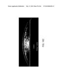 CONFORMABLE THERAPEUTIC SHIELD FOR VISION AND PAIN diagram and image