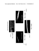 CONFORMABLE THERAPEUTIC SHIELD FOR VISION AND PAIN diagram and image