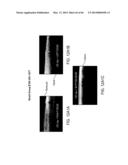 CONFORMABLE THERAPEUTIC SHIELD FOR VISION AND PAIN diagram and image