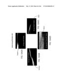 CONFORMABLE THERAPEUTIC SHIELD FOR VISION AND PAIN diagram and image