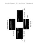 CONFORMABLE THERAPEUTIC SHIELD FOR VISION AND PAIN diagram and image