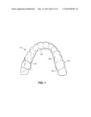 MOUTHPIECE FOR ATHLETIC PERFORMANCE ENHANCEMENT diagram and image