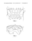 MOUTHPIECE FOR ATHLETIC PERFORMANCE ENHANCEMENT diagram and image
