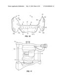 MOUTHPIECE FOR ATHLETIC PERFORMANCE ENHANCEMENT diagram and image