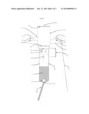 FOAM OR MOUSSE-PRODUCING DEVICE diagram and image