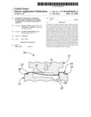 METHOD OF MOLDING COMPOSITE PLASTIC SHEET MATERIAL TO FORM A COMPRESSION     MOLDED, DEEP-DRAWN ARTICLE diagram and image