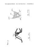 Engine Hood Arrangement diagram and image