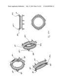 Engine Hood Arrangement diagram and image