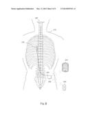 IMPLANT CURRENT CONTROLLED BATTERY CHARGING BASED ON TEMPERATURE diagram and image