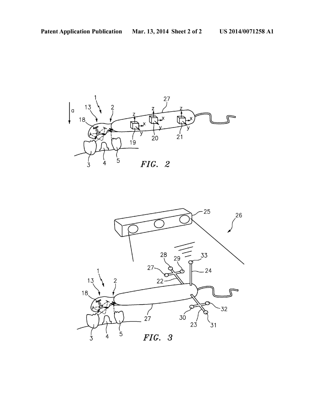 DEVICE FOR DETERMINING THE 3D COORDINATES OF AN OBJECT, IN PARTICULAR OF A     TOOTH - diagram, schematic, and image 03