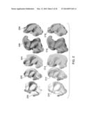 METHODOLOGY FOR DETERMINING AN IMPROVED FORM OF HEADPHONES diagram and image