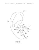 METHODOLOGY FOR DETERMINING AN IMPROVED FORM OF HEADPHONES diagram and image