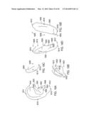 METHODOLOGY FOR DETERMINING AN IMPROVED FORM OF HEADPHONES diagram and image