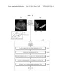 METHOD AND APPARATUS FOR MEDICAL IMAGE REGISTRATION diagram and image