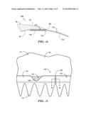 ATTACHMENT SYSTEM FOR A WIND TURBINE ROTOR BLADE ACCESSORY diagram and image