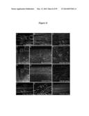 COMPOSITIONS AND METHODS FOR THE TREATMENT OF KRABBE AND OTHER     NEURODEGENERATIVE DISEASES diagram and image