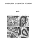 COMPOSITIONS AND METHODS FOR THE TREATMENT OF KRABBE AND OTHER     NEURODEGENERATIVE DISEASES diagram and image