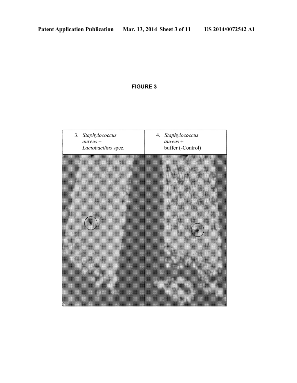 Methods and Means for Protecting the Skin Against Pathogenic     Microorganisms - diagram, schematic, and image 04