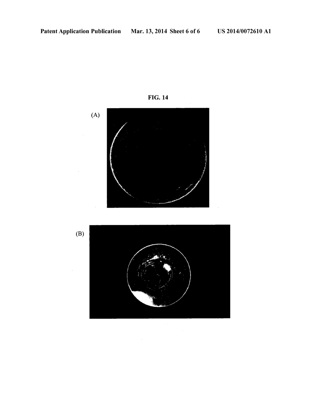 BIOABSORBABLE TRACHEAL STENT, AND METHOD OF MANUFACTURING THEREOF - diagram, schematic, and image 07