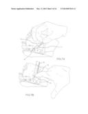 RAPIDLY ACTING DRY SEALANT AND METHODS FOR USE AND MANUFACTURE diagram and image