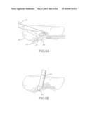 RAPIDLY ACTING DRY SEALANT AND METHODS FOR USE AND MANUFACTURE diagram and image