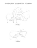 RAPIDLY ACTING DRY SEALANT AND METHODS FOR USE AND MANUFACTURE diagram and image