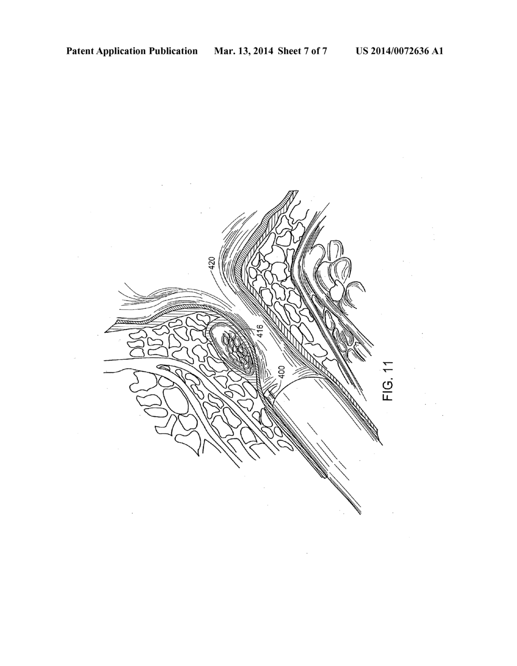 BULKING AGENTS - diagram, schematic, and image 08