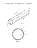 ROTATIONAL SPUN MATERIAL COVERED MEDICAL APPLIANCES AND METHODS OF     MANUFACTURE diagram and image