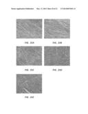 ROTATIONAL SPUN MATERIAL COVERED MEDICAL APPLIANCES AND METHODS OF     MANUFACTURE diagram and image