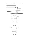 ROTATIONAL SPUN MATERIAL COVERED MEDICAL APPLIANCES AND METHODS OF     MANUFACTURE diagram and image