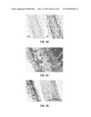 ROTATIONAL SPUN MATERIAL COVERED MEDICAL APPLIANCES AND METHODS OF     MANUFACTURE diagram and image